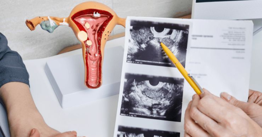 Expert Gynecologic Oncology Treatments In Delhi | Dr. Divya Sehra